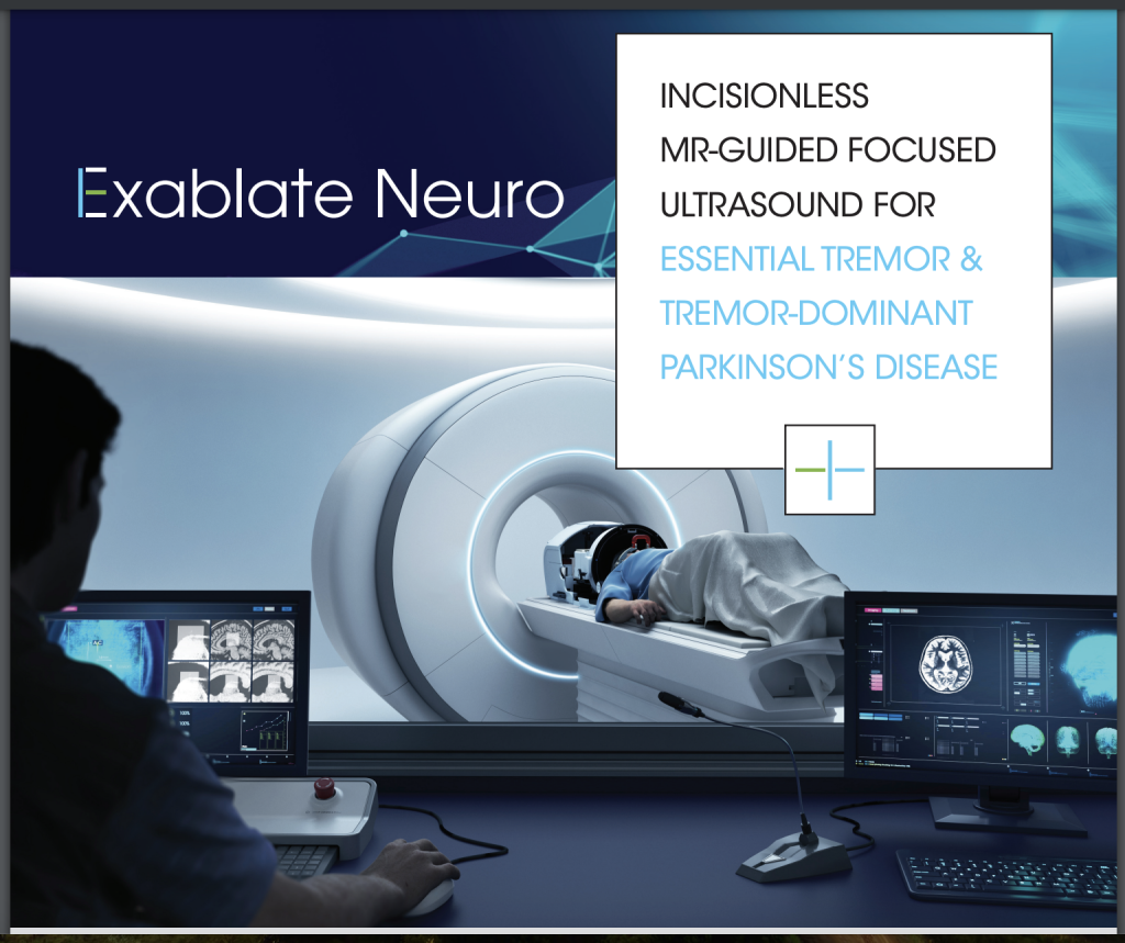 MRI-Guided - Focussed UltrasoundFocussed Ultrasound